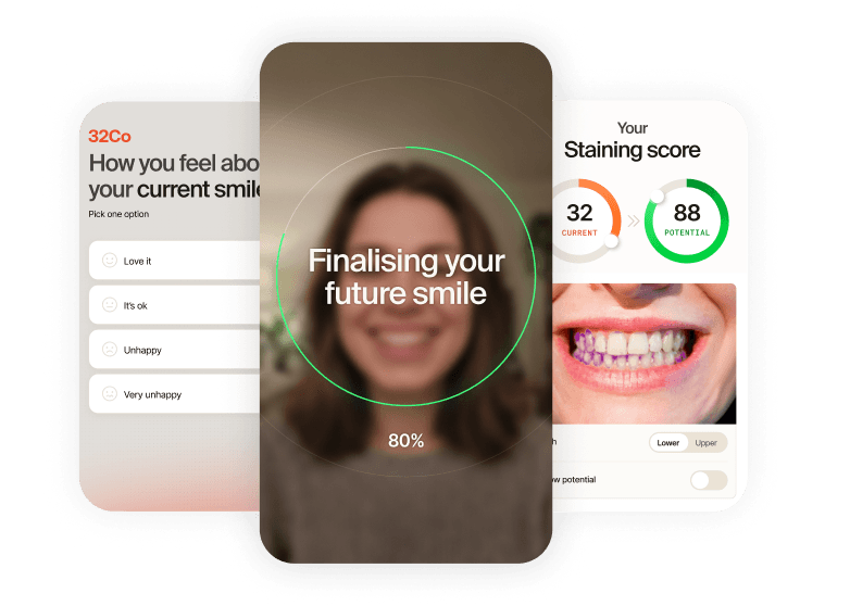 Always-on AI lead generation — smile-scan app mockups