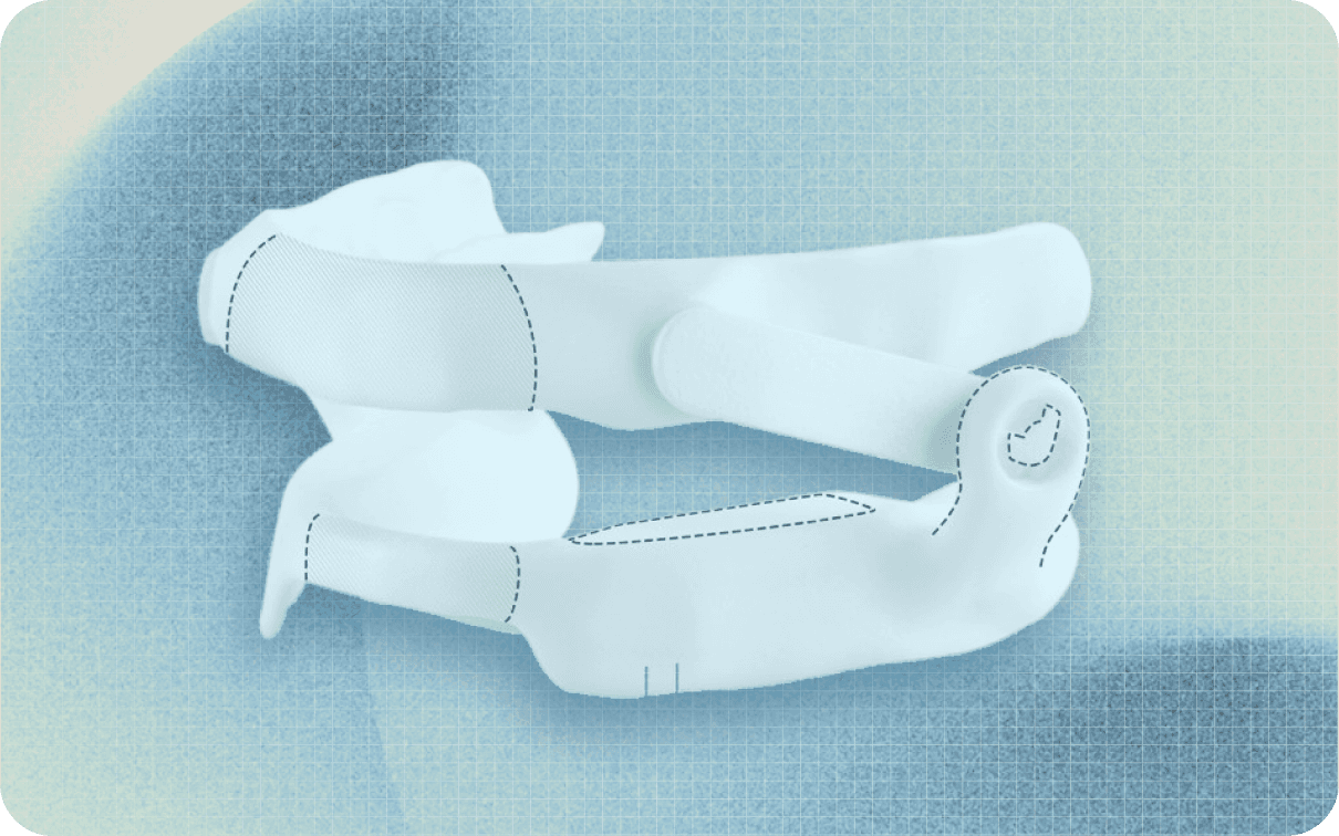 Aerox device — custom-fit appliance on a textured pastel background